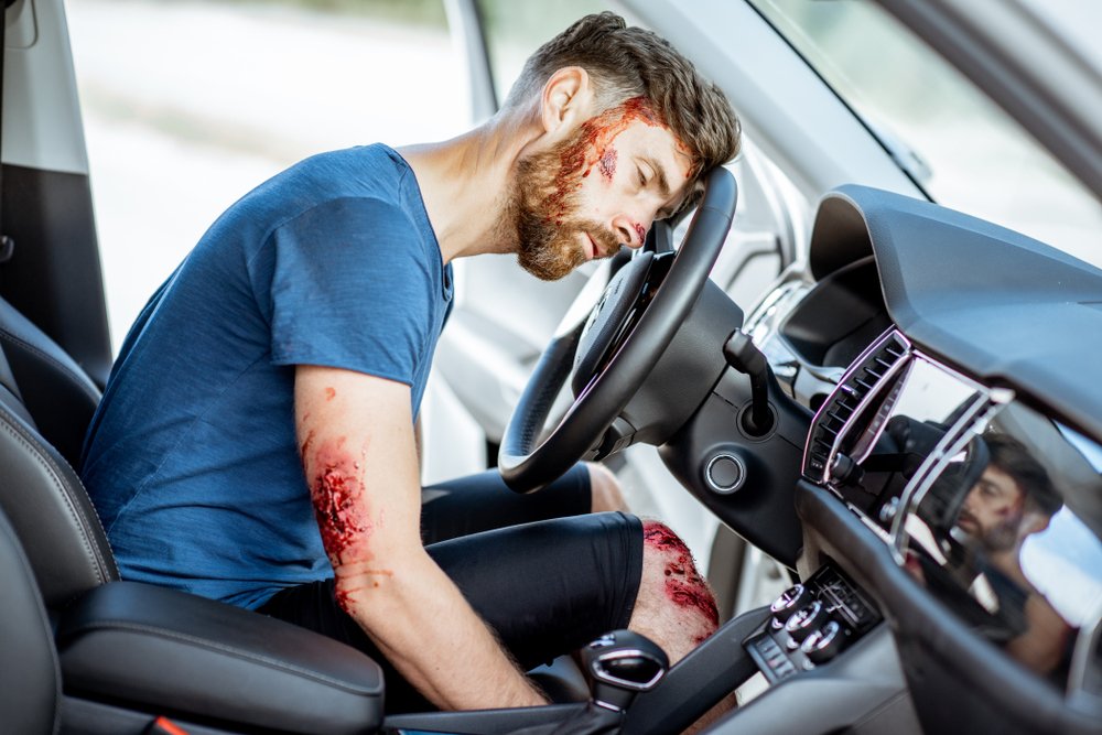 4 Tips on Car Accident Injury Lawyers  You Cannot Afford To miss