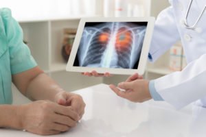 Lung Cancer and Camp Lejeune Contamination